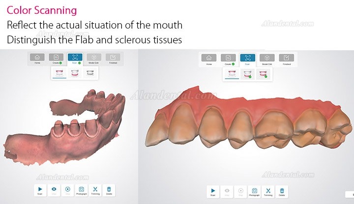 Fussen Dental 3D Digital Intraoral Scanner